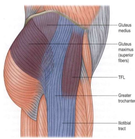 Hip Bursitis? . . . It may not be what you think.